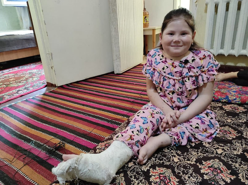 Oyoqda ''kishan'' bilan 11 yildan buyon yashayotgan qiz