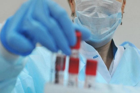Ўзбекистонда коронавируснинг «ҳиндча» штамми аниқланди