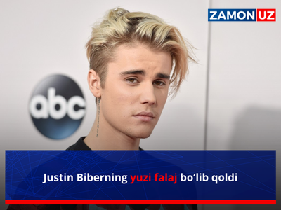 Justin Biberning yuzi falaj bo‘lib qoldi