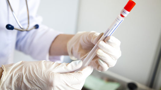 Olimlar antibiotiklarning yangi turini aniqlashdi