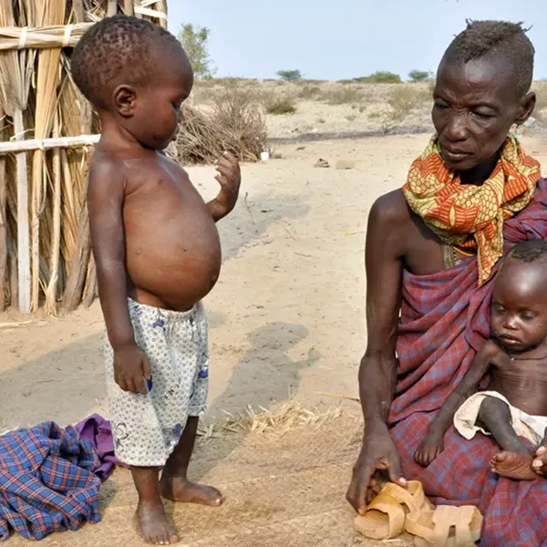Afrikada katta qorin boylik belgisi hisoblanadi