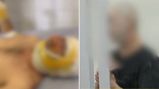 Тошкентда эркак аёлини ёқиб юборди
