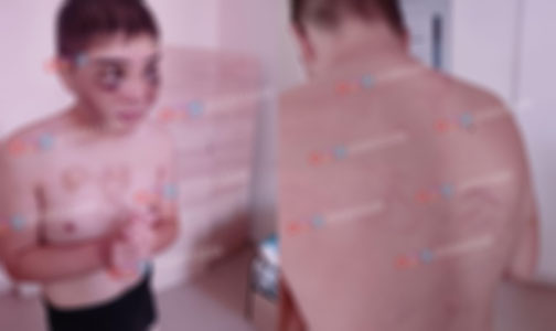 Тошкентда ногиронлиги бўлган бола аёвсиз калтакланди