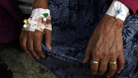 Afrikada kolera tarqalishi ortidan joriy yilda qariyb 7 ming inson vafot etdi